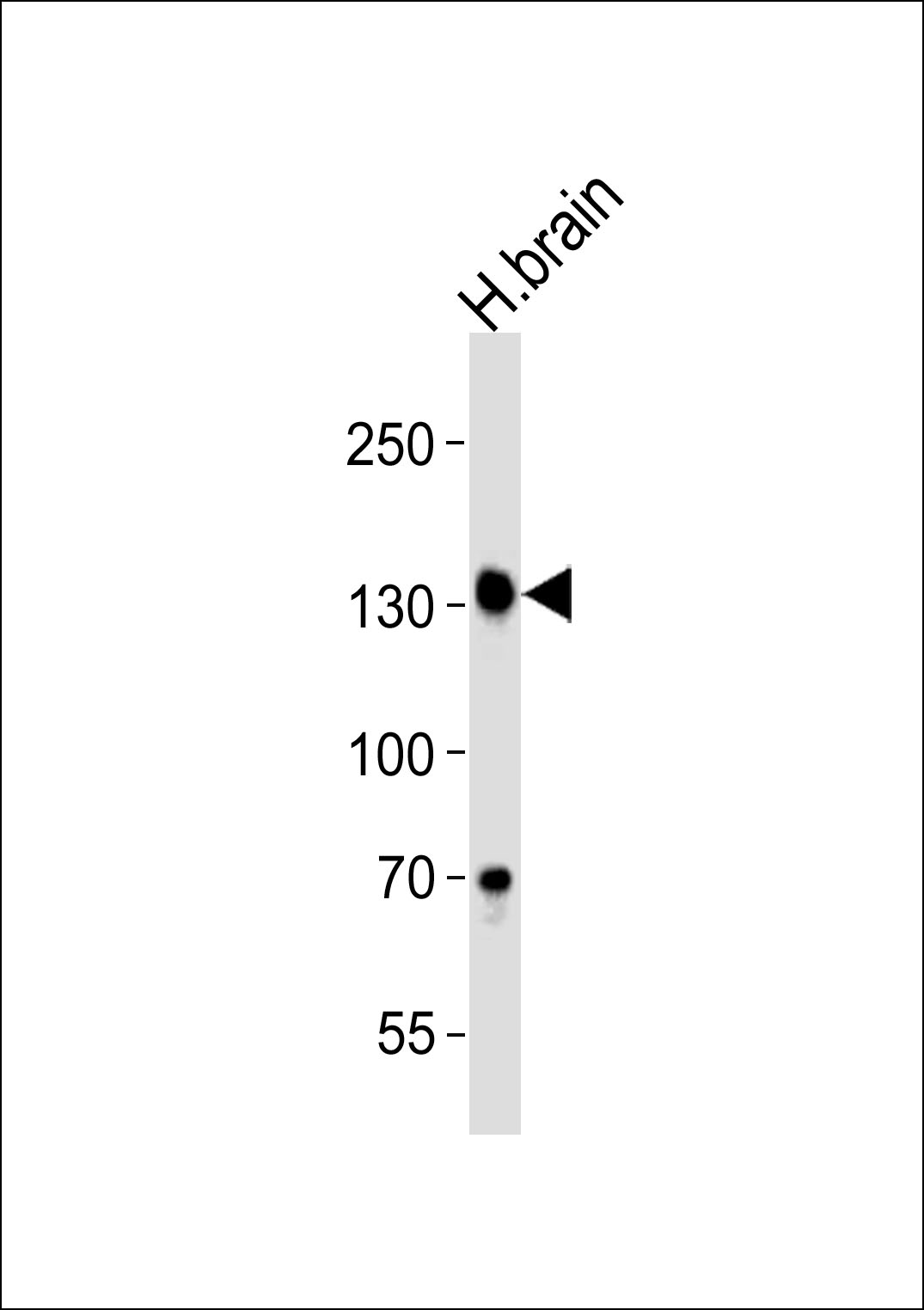 Western blot analysis of lysate from human brain tissue lysate, using ZNF423 Antibody  (Center)(Cat.  #AP20776c).  AP20776c was diluted at 1:1000.  A goat anti-rabbit IgG H&L(HRP) at 1:5000 dilution was used as the secondary antibody. Lysate at 35ug.