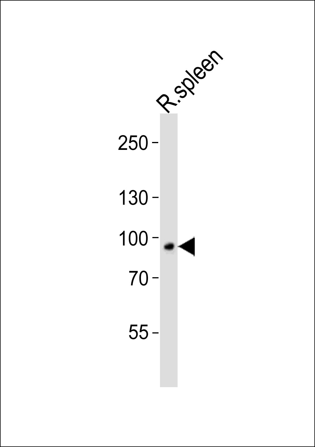 Western blot analysis of lysate from rat spleen tissue lysate, using VAC14 Antibody (C-term)(Cat.  #AP20783c).  AP20783c was diluted at 1:1000.  A goat anti-rabbit IgG H&L(HRP) at 1:5000 dilution was used as the secondary antibody. Lysate at 35ug.