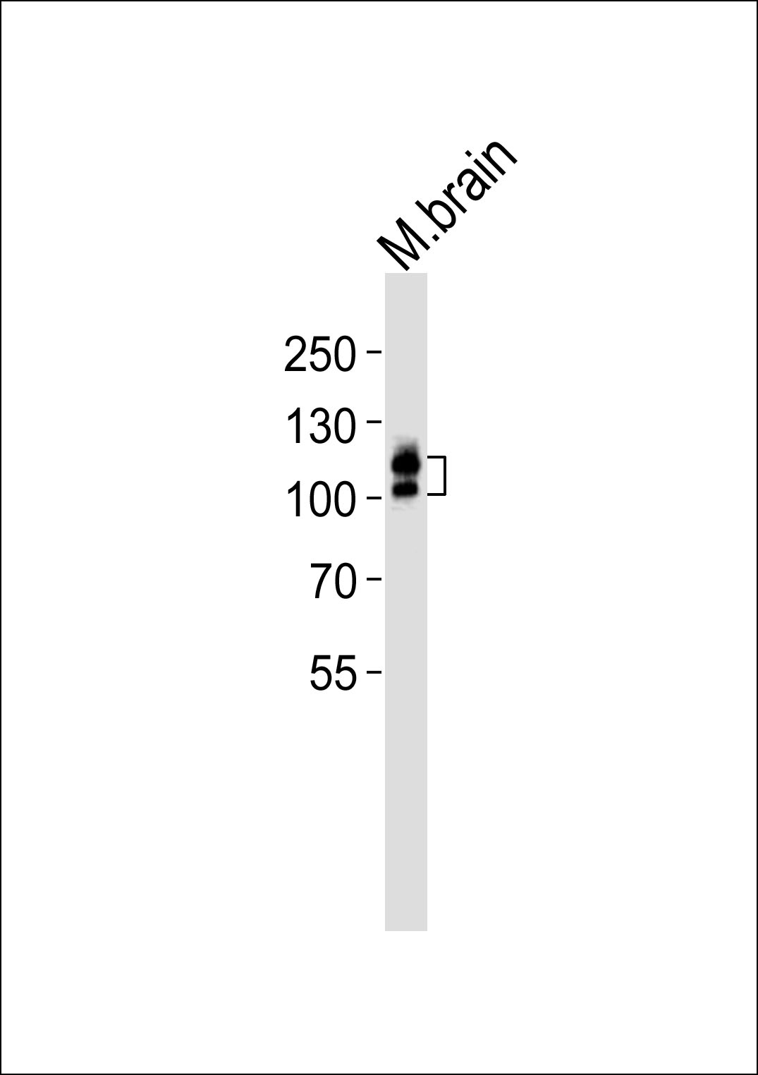 Western blot analysis of lysate from mouse brain tissue lysate, using KIT Antibody (Center)(Cat.  #AP20811c).  AP20811c was diluted at 1:1000.  A goat anti-rabbit IgG H&L(HRP) at 1:10000 dilution was used as the secondary antibody. Lysate at 35ug.