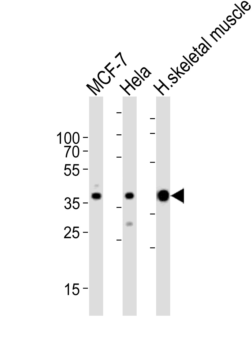 Western blot analysis of lysates from MCF-7, Hela cell line and human skeletal muscle tissue lysate (from left to right), using ALDOA Antibody (C-term)(Cat.  #AP2726b).  AP2726b was diluted at 1:1000 at each lane.  A goat anti-rabbit IgG H&L(HRP) at 1:10000 dilution was used as the secondary antibody. Lysates at 35ug per lane.