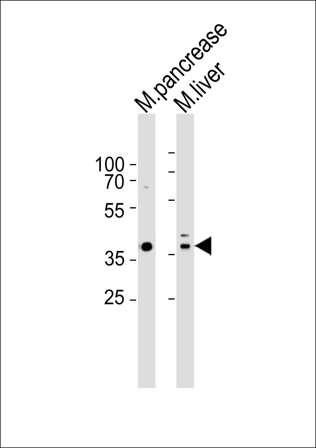WB - Mouse Hmx3 Antibody (C-term) AP7424b