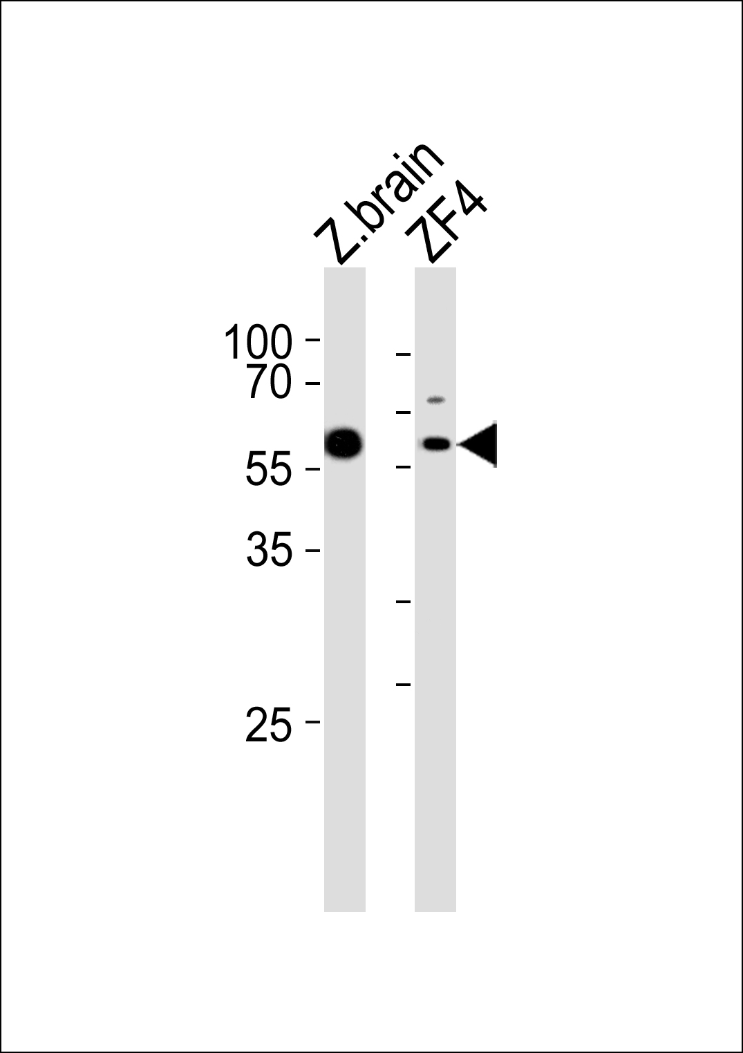 Western blot analysis of lysates from zebra fish brain, ZF4 tissue lysate (from left to right), using (DANRE) papl Antibody (C-term)(Cat.  #Azb18704c).  Azb18704c was diluted at 1:1000 at each lane.  A goat anti-rabbit IgG H&L(HRP) at 1:5000 dilution was used as the secondary antibody. Lysates at 35ug per lane.