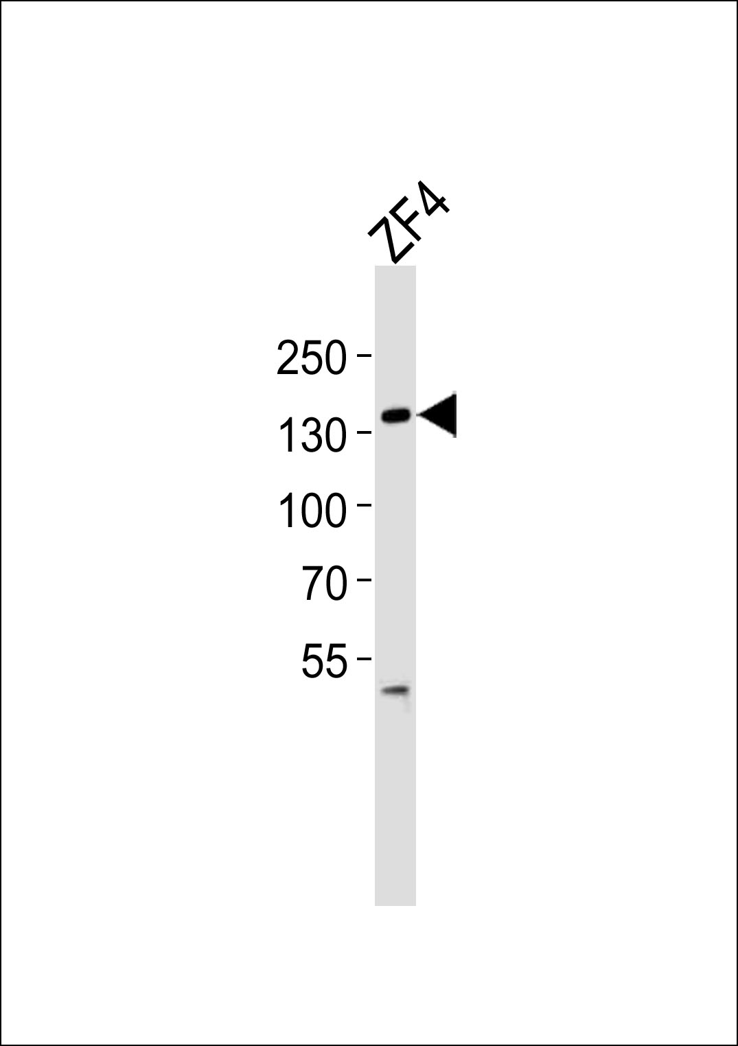 Western blot analysis of lysate from ZF4 cell line, using (DANRE) pkn2 Antibody  (N-term)(Cat.  #Azb18708a).  Azb18708a was diluted at 1:1000.  A goat anti-rabbit IgG H&L(HRP) at 1:5000 dilution was used as the secondary antibody. Lysate at 35ug.