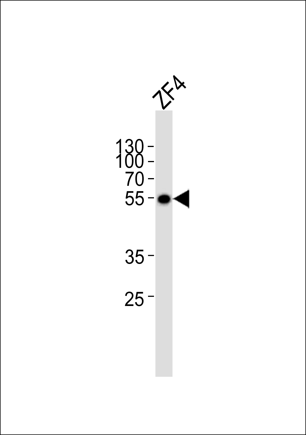 Western blot analysis of lysate from ZF4 cell line, using (DANRE) ankrd13c Antibody (C-term)(Cat.  #Azb18714c).  Azb18714c was diluted at 1:1000.  A goat anti-rabbit IgG H&L(HRP) at 1:5000 dilution was used as the secondary antibody. Lysate at 35ug.