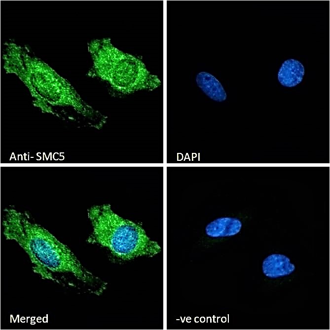 IF - SMC5 Antibody (Internal region) AF2971a