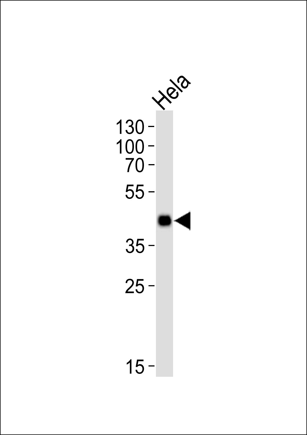WB - Mouse Mapkapk3 Antibody (N-term) AP14268a