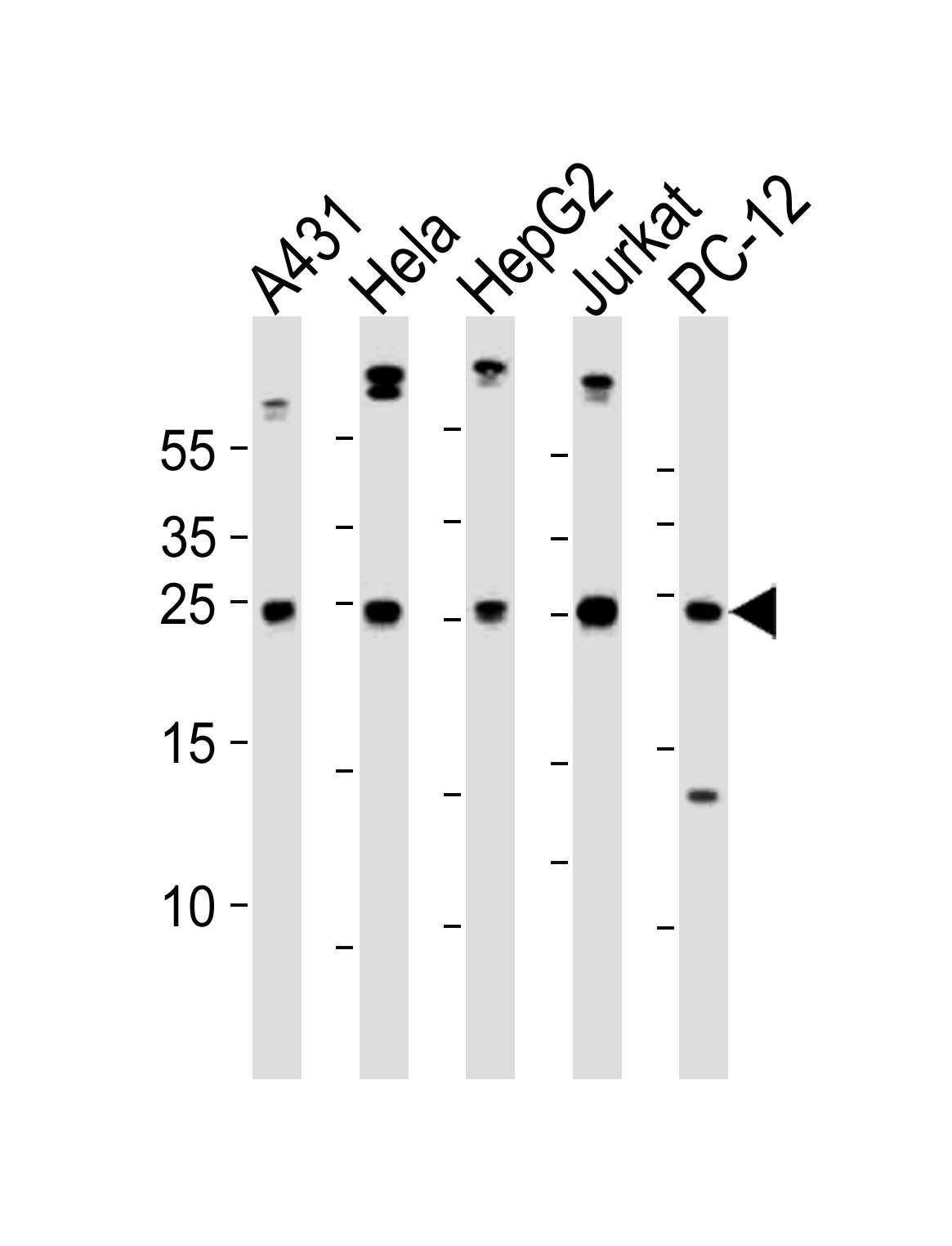 Western blot analysis of lysates from A431,  Hela,  HepG2,  Jurkat,  rat PC-12 cell line (from left to right),  using BCL2L1 Antibody (C-term)(Cat.  #AP20816c).  AP20816c was diluted at 1:1000 at each lane.  A goat anti-rabbit IgG H&L(HRP) at 1:10000 dilution was used as the secondary antibody. Lysates at 35ug per lane.