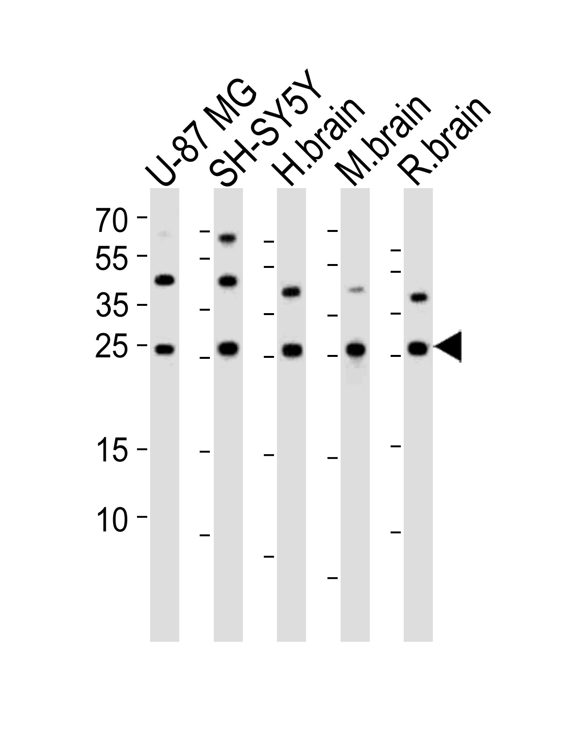 Western blot analysis of lysates from U-87 MG,  SH-SY5Y cell line,  human brain,  mouse brain,  rat brain tissue lysate (from left to right),  using STMN2 Antibody (N-term)(Cat.  #AP20817a).  AP20817a was diluted at 1:1000 at each lane.  A goat anti-rabbit IgG H&L(HRP) at 1:10000 dilution was used as the secondary antibody. Lysates at 35ug per lane.