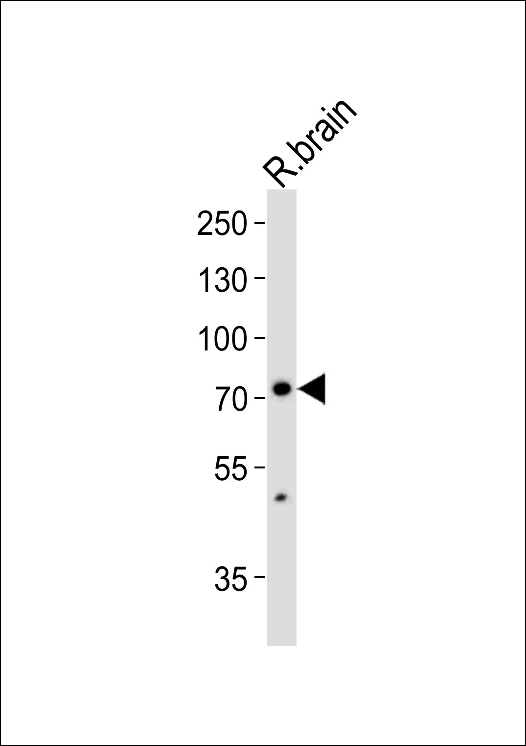 Western blot analysis of lysate from rat brain tissue lysate,  using SV2C Antibody (C-term)(Cat.  #AP20824c).  AP20824c was diluted at 1:1000.  A goat anti-rabbit IgG H&L(HRP) at 1:10000 dilution was used as the secondary antibody. Lysate at 35ug.