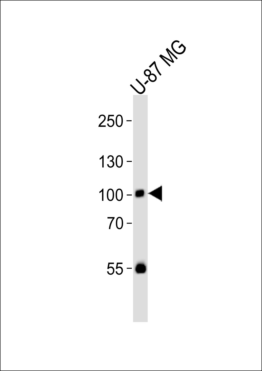 Western blot analysis of lysate from U-87 MG cell line,  using HUMAN-RIN1(Y36) antibody (Cat.  #AP20829a).  AP20829a was diluted at 1:1000.  A goat anti-rabbit IgG H&L(HRP) at 1:10000 dilution was used as the secondary antibody. Lysate at 35ug.