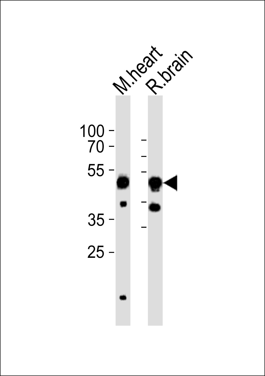 Western blot analysis of lysates from mouse heart, rat brain tissue (from left to right),  using CHRNB3 Antibody (Center)(Cat.  #AP20832c).  AP20832c was diluted at 1:1000 at each lane.  A goat anti-rabbit IgG H&L(HRP) at 1:10000 dilution was used as the secondary antibody. Lysates at 35ug per lane.