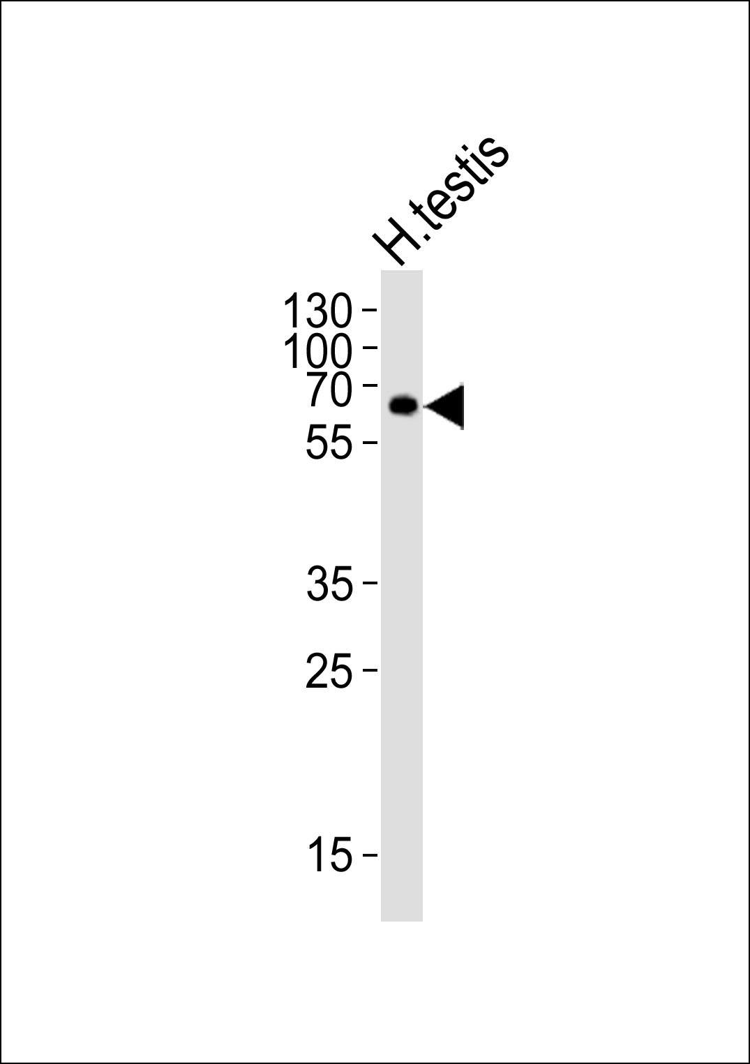 WB - ZIM2 Antibody (N-term) AP20833a