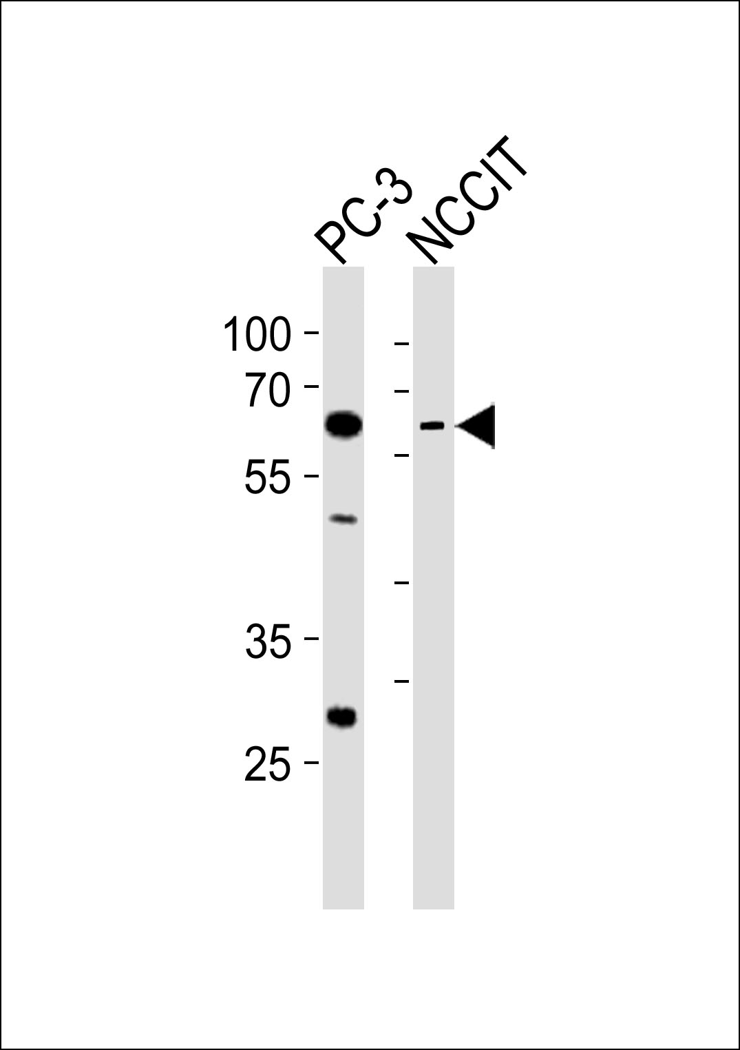 WB - TBX22 Antibody (C-term) AP20844c
