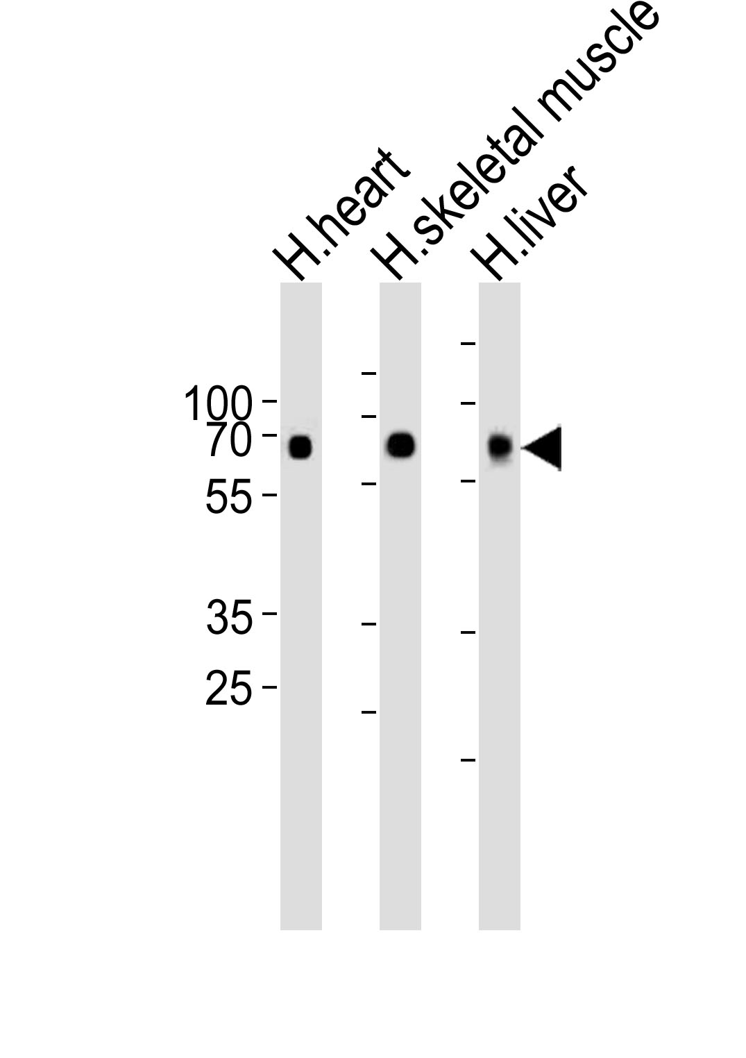 Western blot analysis of lysates from human heart, skeletal muscle and liver tissue lysate (from left to right),  using Cry2 Antibody(R579)(Cat.  #AP6135A).  AP6135A was diluted at 1:1000 at each lane.  A goat anti-rabbit IgG H&L(HRP) at 1:10000 dilution was used as the secondary antibody. Lysates at 35ug per lane.