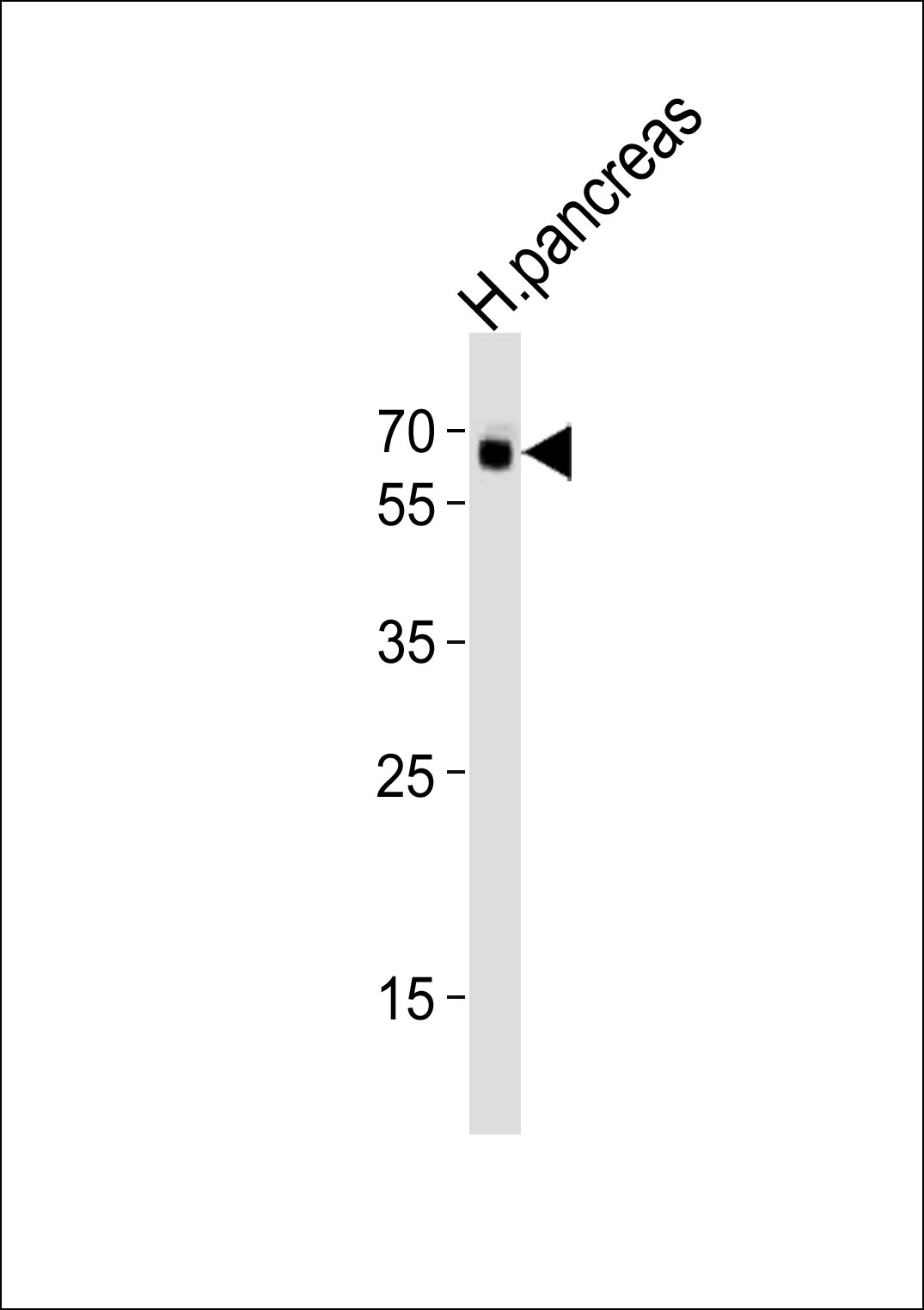 Western blot analysis of lysate from human pancreas tissue lysate,  using ACVR2B Antibody (S14)(Cat.  #AP7105A).  AP7105A was diluted at 1:1000.  A goat anti-rabbit IgG H&L(HRP) at 1:10000 dilution was used as the secondary antibody. Lysate at 35ug.