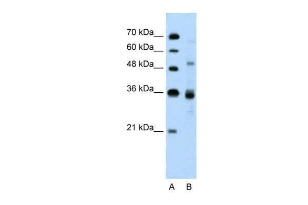 WB - TNRC4 antibody - N-terminal region AI10022