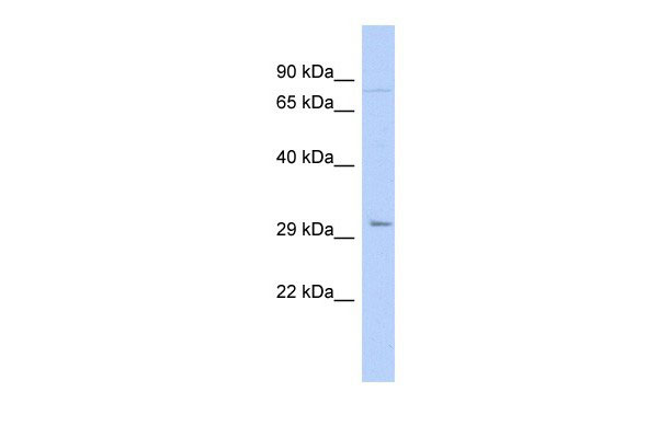 WB - PITX2 antibody - N-terminal region AI10059