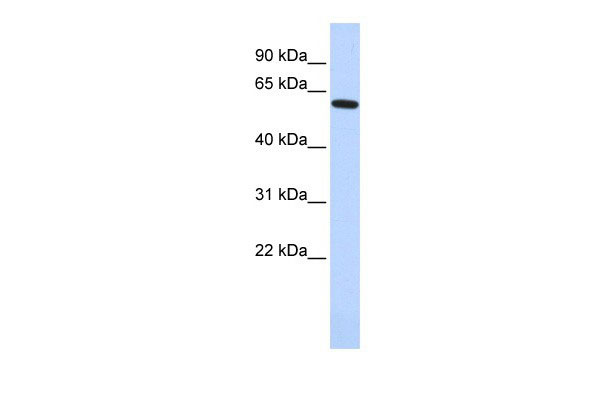 WB - EYA1 antibody - middle region AI10060