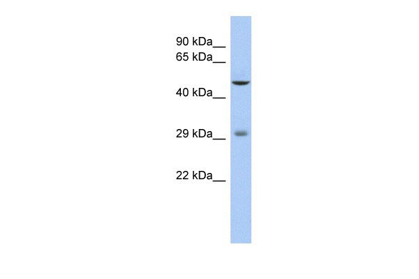 WB - LBX1 antibody - middle region AI10071