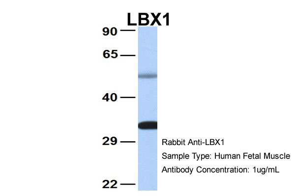 WB - LBX1 antibody - middle region AI10071