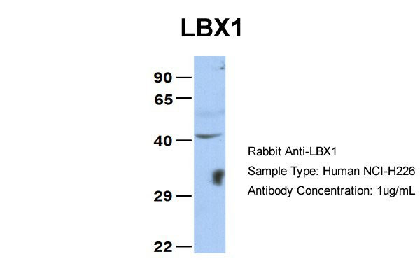 WB - LBX1 antibody - middle region AI10071