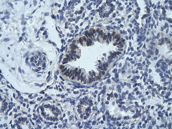 IHC - RCOR1 antibody - middle region AI10129
