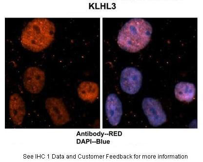 IHC - KLHL3 antibody - N-terminal region AI10138