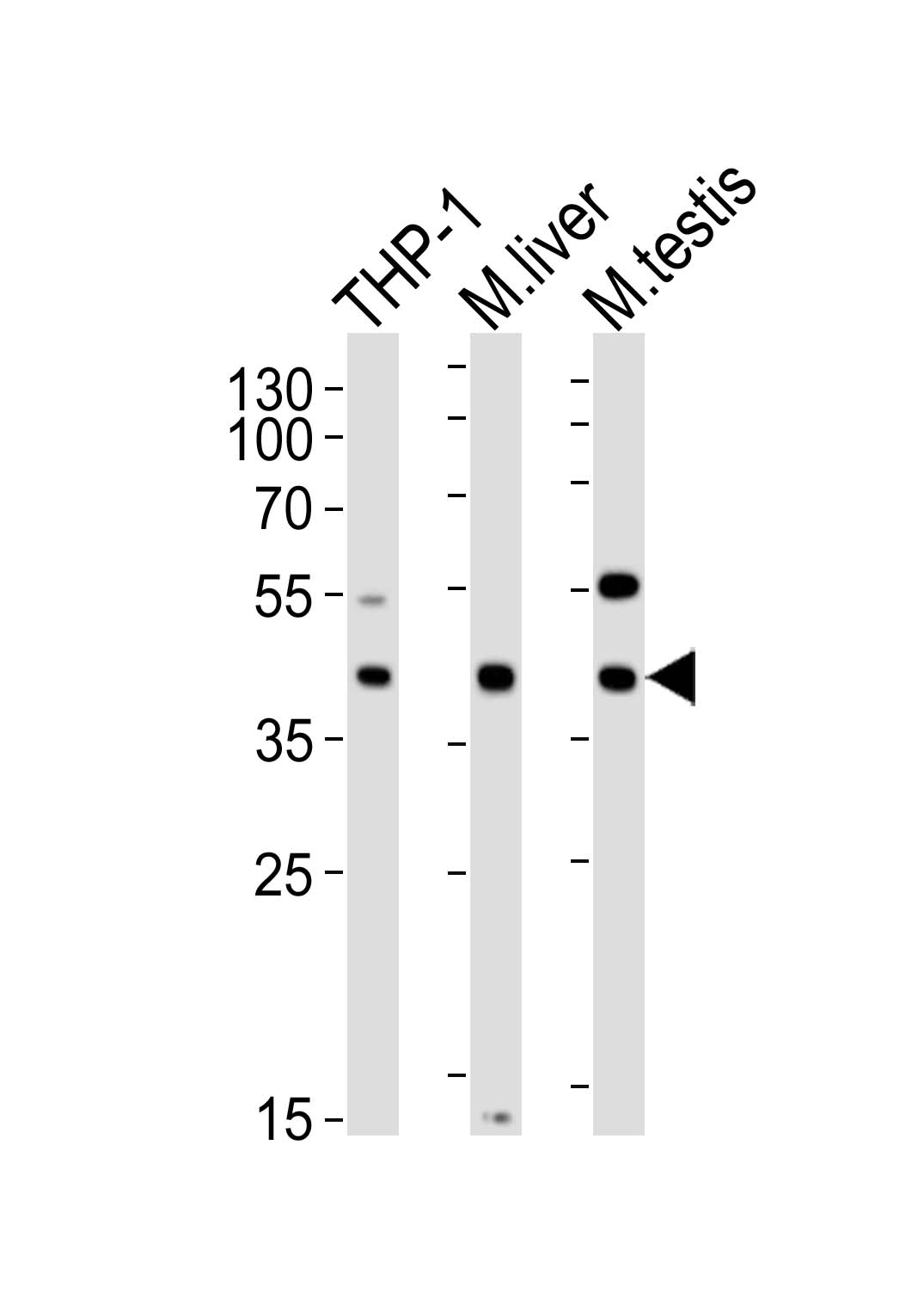 Western blot analysis of lysates from THP-1 cell line, mouse liver, mouse testis tissue (from left to right),  using ATG3 Antibody(Cat.  #AM8441b).  AM8441b was diluted at 1:1000 at each lane.  A goat anti-mouse IgG H&L(HRP) at 1:10000 dilution was used as the secondary antibody. Lysates at 20?g per lane.