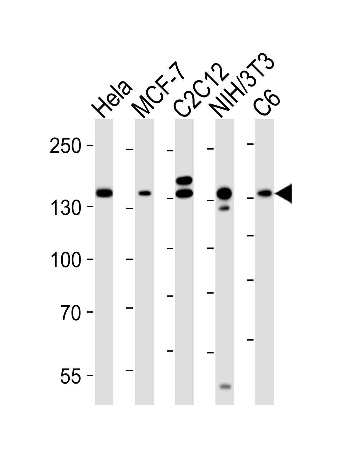 Western blot analysis of lysates from Hela, MCF-7, mouse C2C12, mouse NIH/3T3, rat C6 cell line (from left to right),  using RPTOR Antibody(Cat.  #AM8442b).  AM8442b was diluted at 1:1000 at each lane.  A goat anti-mouse IgG H&L(HRP) at 1:10000 dilution was used as the secondary antibody. Lysates at 20?g per lane.