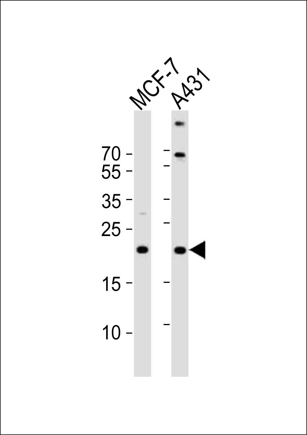 WB - TIMM23 Antibody (C-term) AP14103B