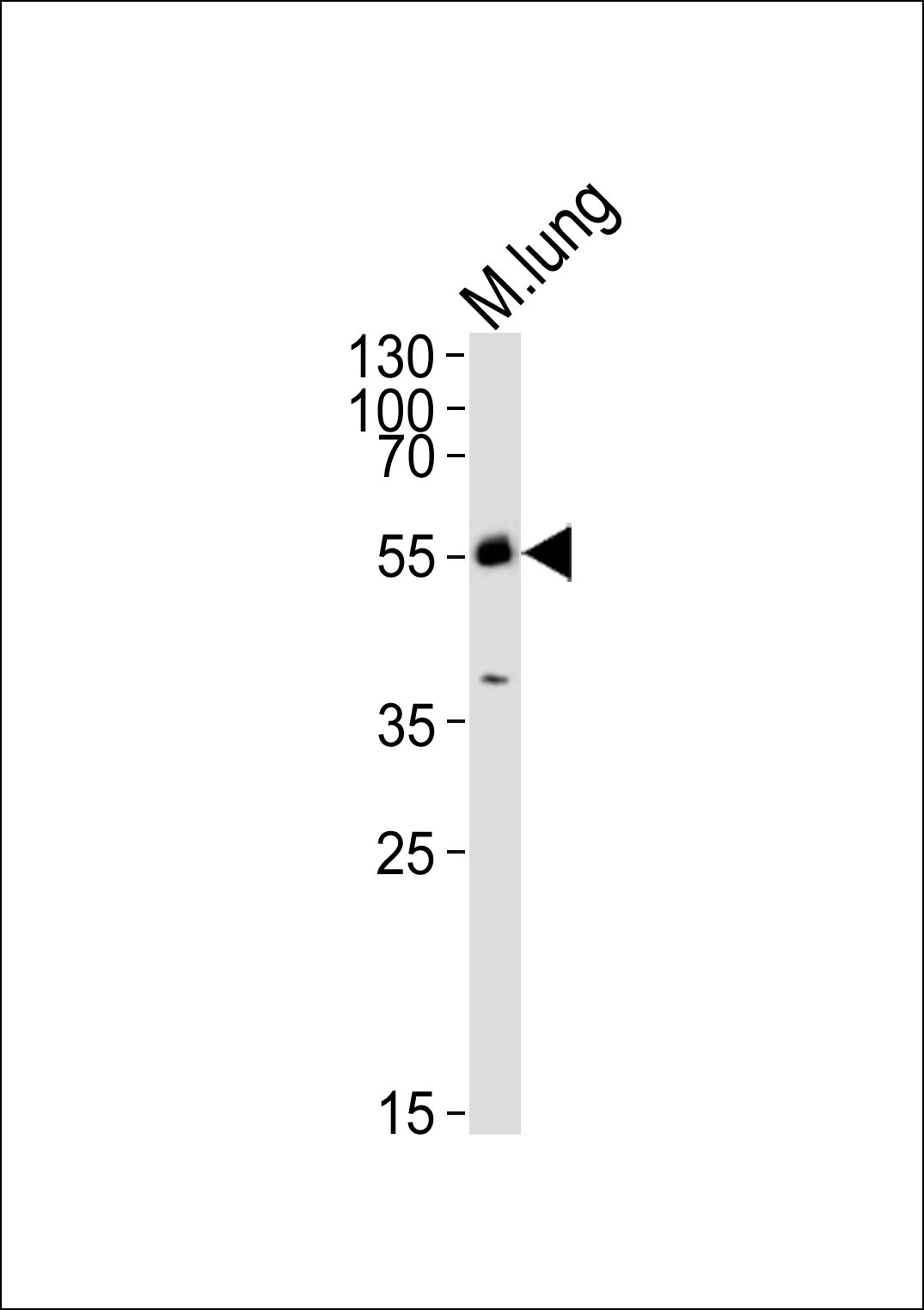 WB - M Mlkl Antibody (C-term) AP14272B