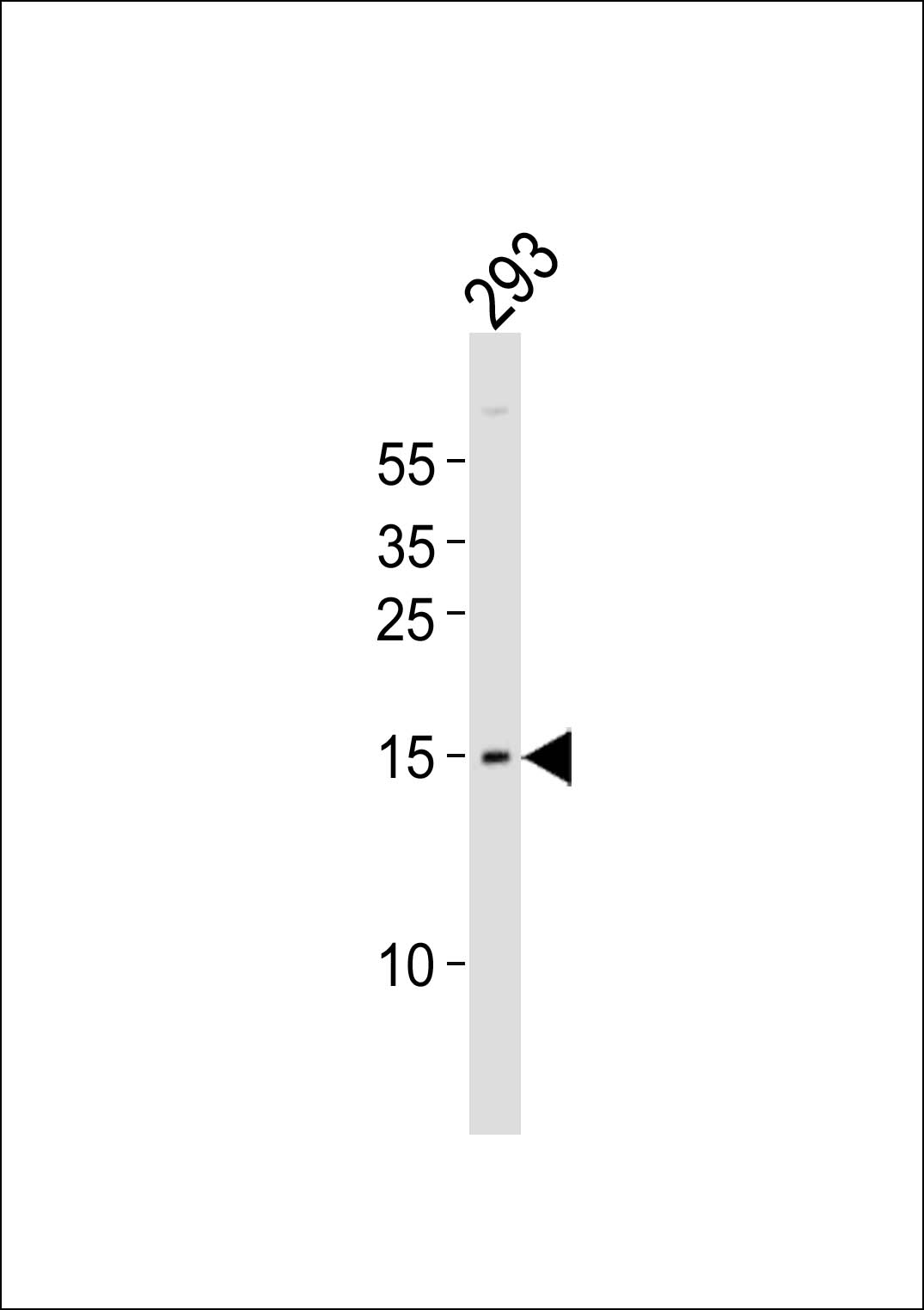 WB - BATF Antibody (N-term) AP16614A