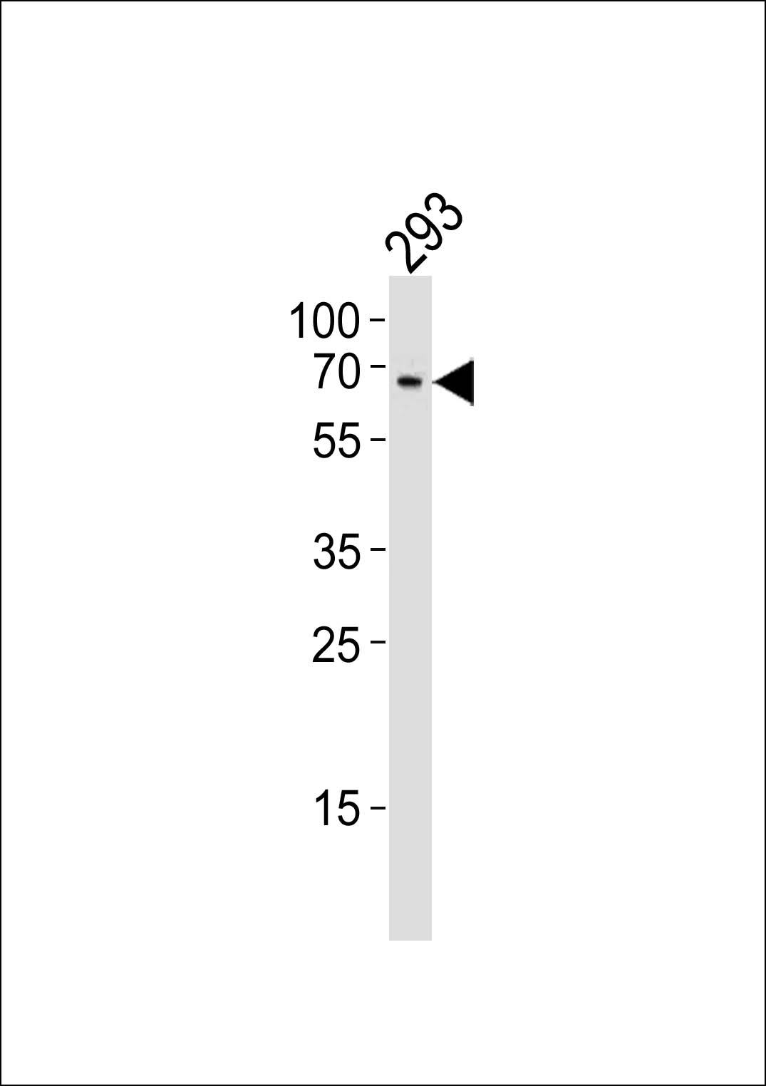 WB - TESK1 Antibody (Center) AP16795c