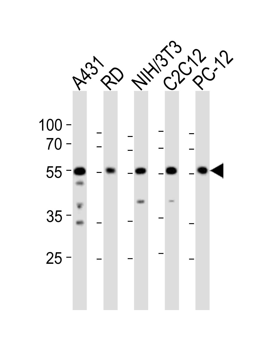 WB - SRC Antibody(N-term) AP19615a