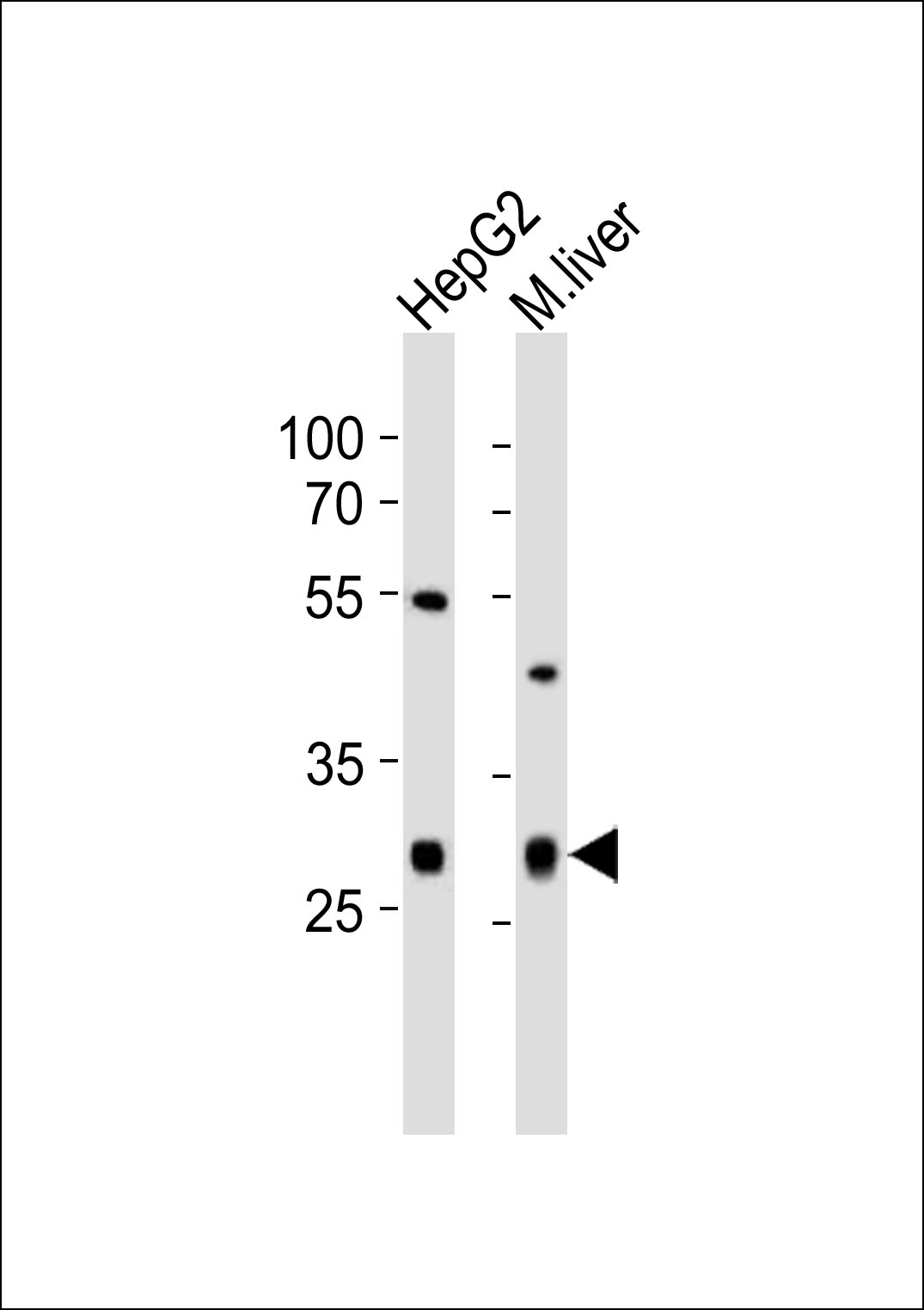 Western blot analysis of lysates from HepG2 cell line,  mouse liver tissue lysate (from left to right),   using CTDSP1 Antibody (N-term)(Cat.   #AP20752a).   AP20752a was diluted at 1:1000 at each lane.   A goat anti-rabbit IgG H&L(HRP) at 1:10000 dilution was used as the secondary antibody.  Lysates at 20ug per lane.