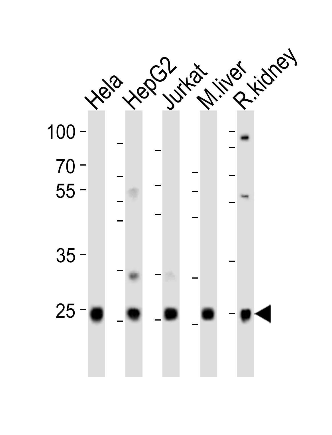 Western blot analysis of lysates from Hela, HepG2, Jurkat cell line, mouse liver, rat kidney tissue(from left to right),  using UBB(Ubiquitin) Antibody (N-term)(Cat.  #AP20853a).  AP20853a was diluted at 1:1000 at each lane.  A goat anti-rabbit IgG H&L(HRP) at 1:10000 dilution was used as the secondary antibody. Lysates at 20ug per lane.