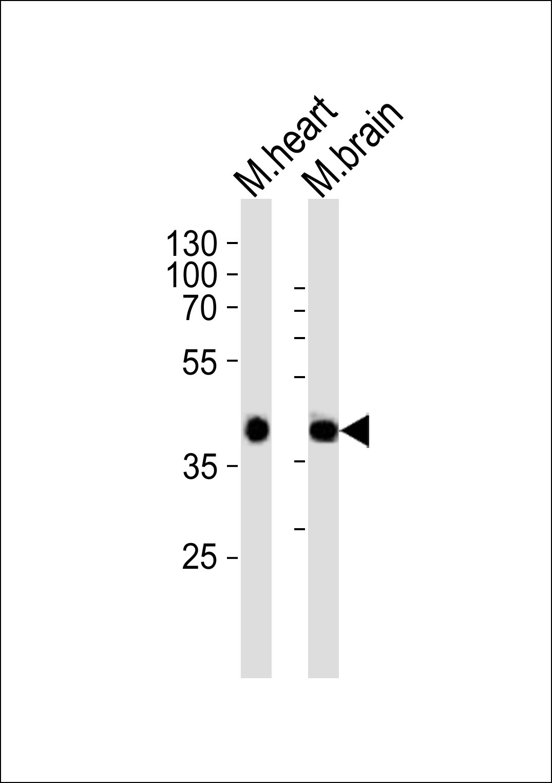 WB - Mouse Sbk1 Antibody (N-term) AP20874b