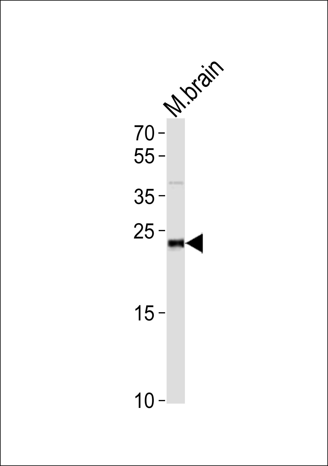 WB - PrLZ Antibody (Center) AP20875a