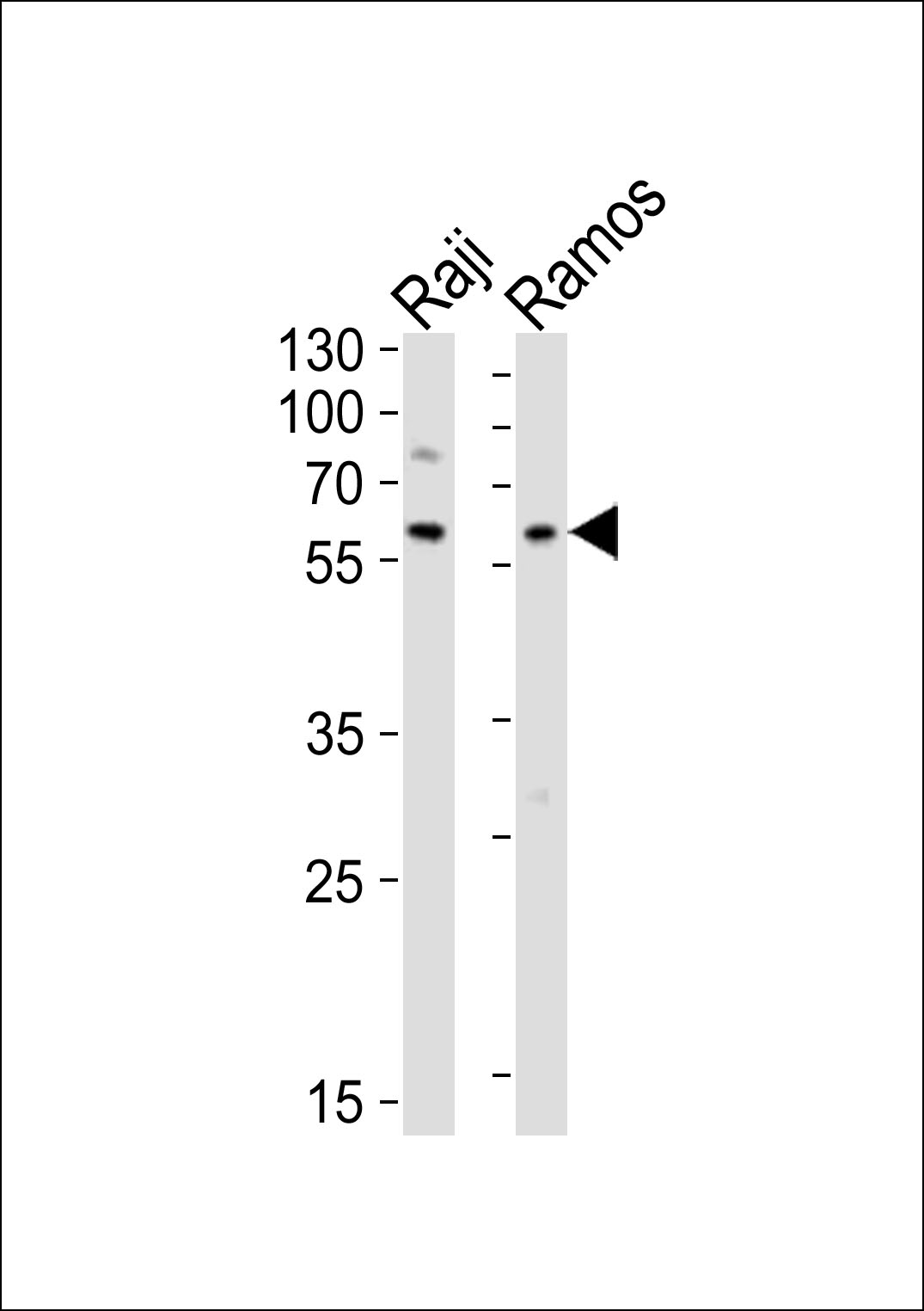 Western blot analysis of lysates from Raji, Ramos cell line (from left to right),  using LYN Antibody (N-term)(Cat.  #AP20882b).  AP20882b was diluted at 1:1000 at each lane.  A goat anti-rabbit IgG H&L(HRP) at 1:10000 dilution was used as the secondary antibody. Lysates at 20ug per lane.