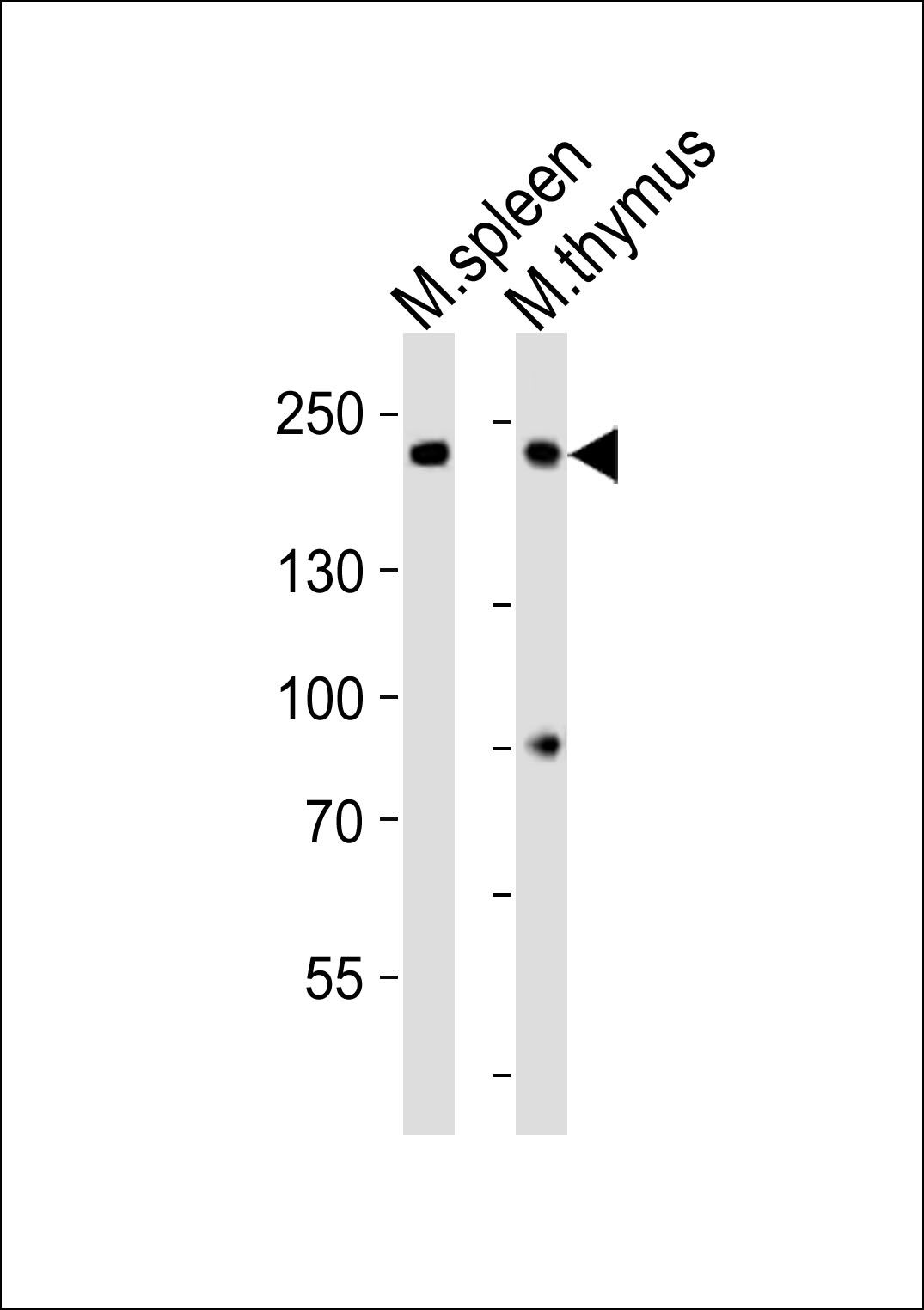 WB - (Mouse) Zcchc11 Antibody (C-term) AP20889c