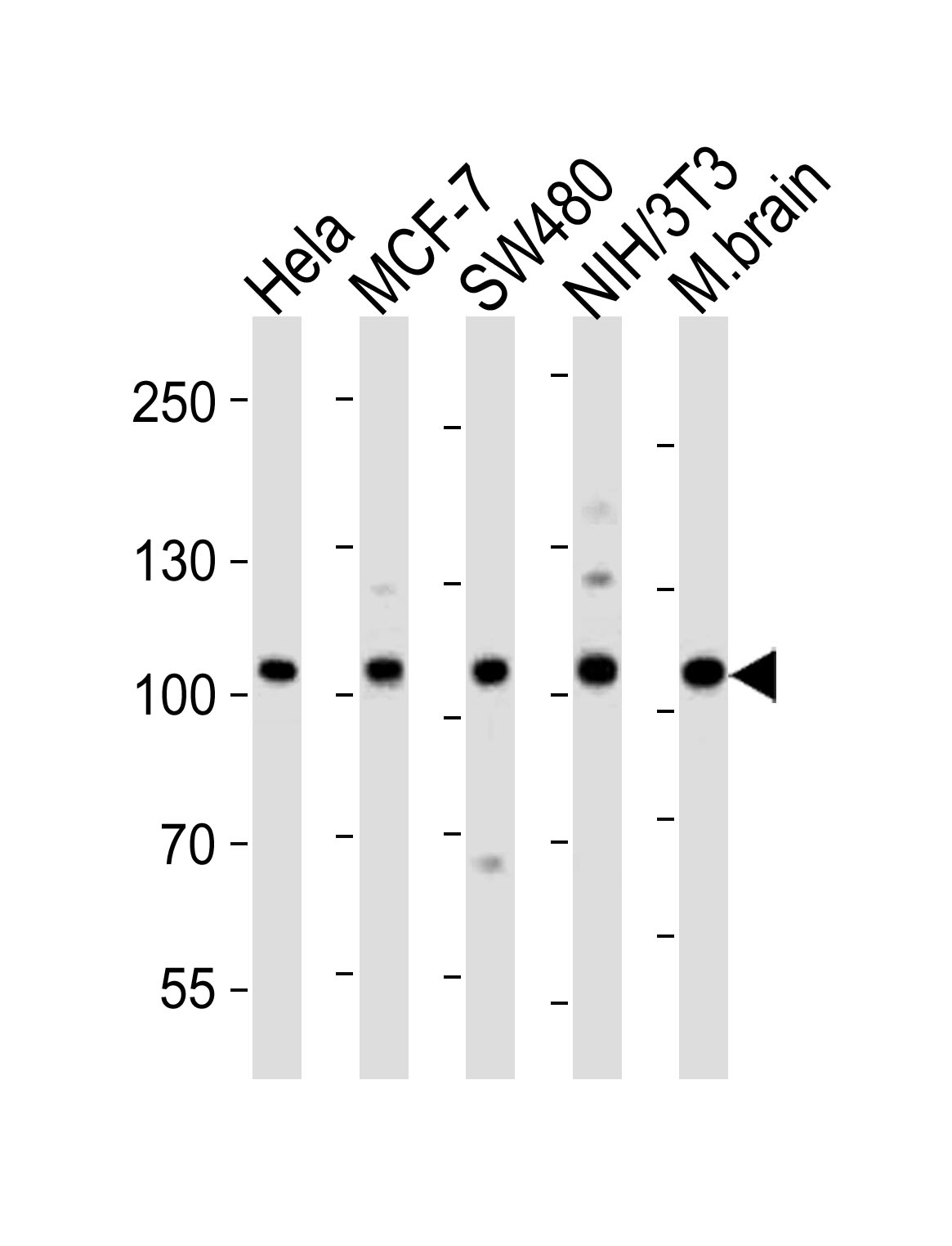Western blot analysis of lysates from Hela, MCF-7, SW480, mouse NIH/3T3 cell line, mouse brain tissue lysate (from left to right),  using EPHA4 Antibody (Center)(Cat.  #AP20902a).  AP20902a was diluted at 1:1000 at each lane.  A goat anti-rabbit IgG H&L(HRP) at 1:10000 dilution was used as the secondary antibody. Lysates at 20ug per lane.