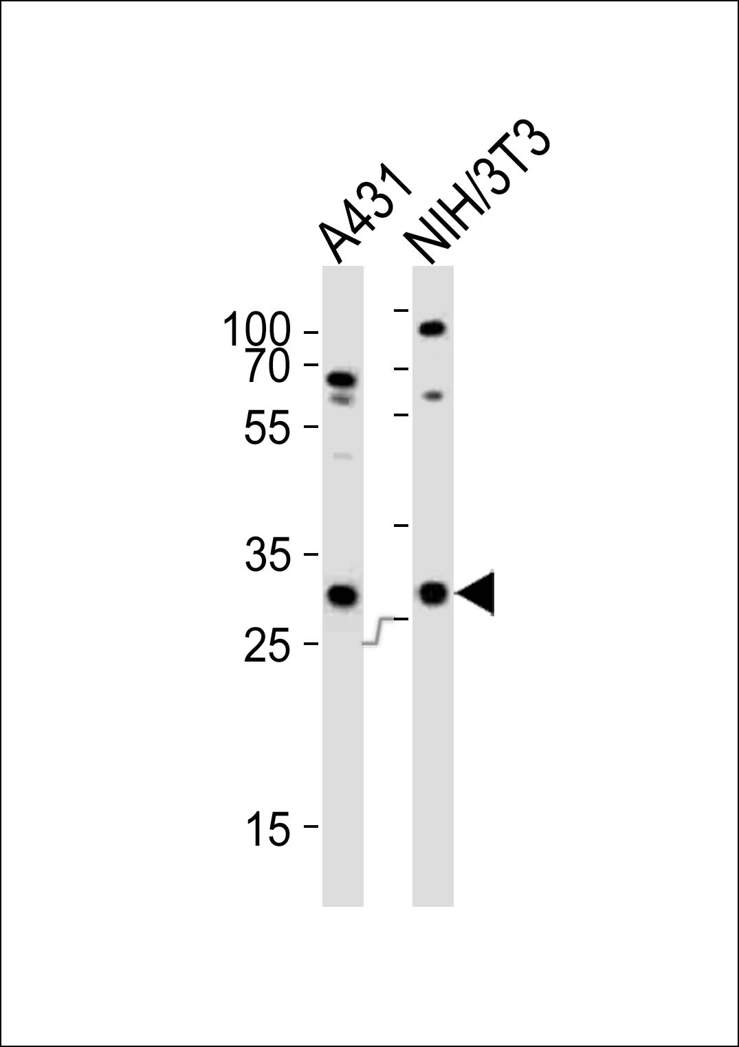 Western blot analysis of lysates from A431, mouse NIH/3T3 cell line (from left to right),  using CDK5 Antibody (C-term)(Cat.  #AP20910c).  AP20910c was diluted at 1:1000 at each lane.  A goat anti-rabbit IgG H&L(HRP) at 1:10000 dilution was used as the secondary antibody. Lysates at 20ug per lane.