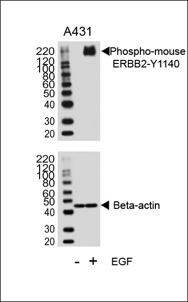 Western blot analysis of lysates from A431 cell line, untreated or treated with EGF, 100ng/ml, using Phospho-mouse ERBB2-Y1140(Cat.  #AP3781q)(upper) or Beta-actin (lower).