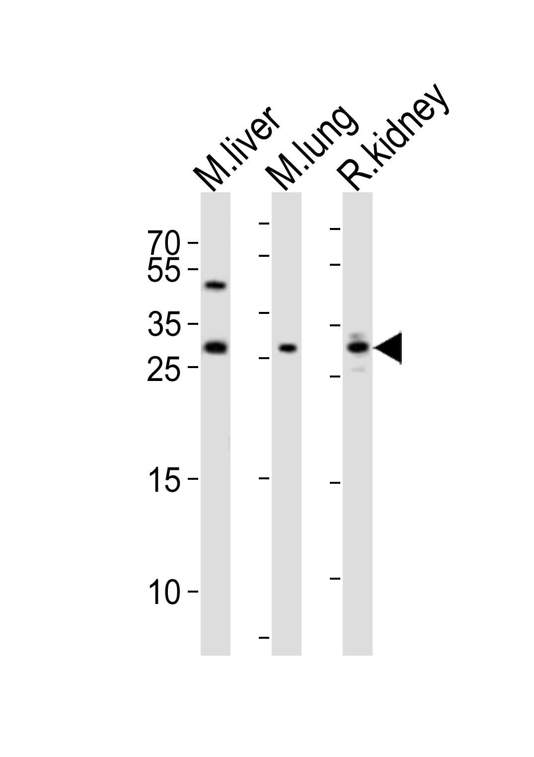 Western blot analysis of lysates from mouse liver, mouse lung, rat kidney tissue lysate (from left to right),  using SOST Antibody (N-term)(Cat.  #AP6261a).  AP6261a was diluted at 1:1000 at each lane.  A goat anti-rabbit IgG H&L(HRP) at 1:10000 dilution was used as the secondary antibody. Lysates at 20ug per lane.