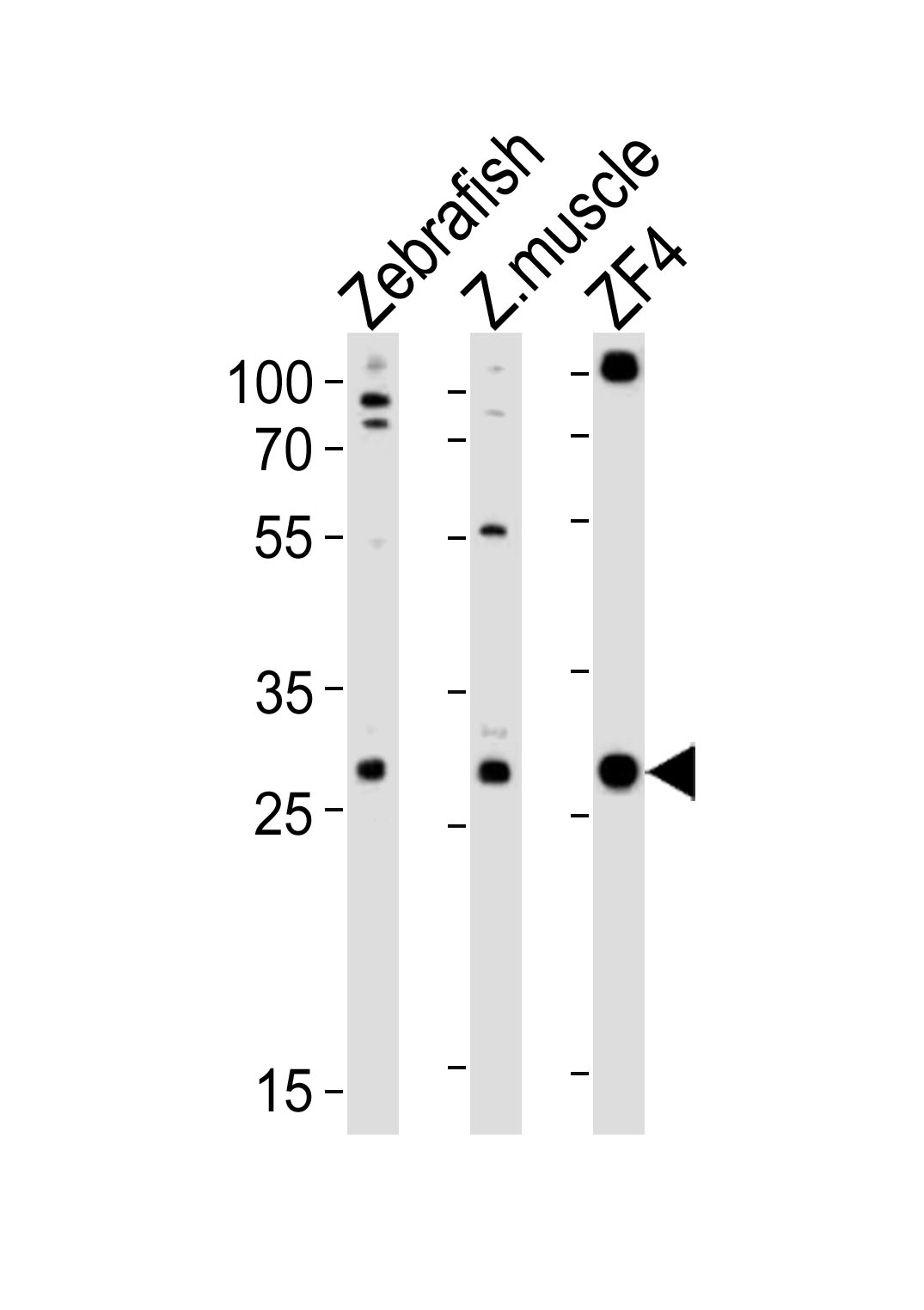 Western blot analysis of lysates from Zebrafish, zebra fish muscle tissue lysate, ZF4 cell line (from left to right),  using (DANRE) ak2 Antibody (N-term)(Cat. #Azb18720b).  Azb18720b was diluted at 1:1000 at each lane. A goat anti-rabbit IgG H&L(HRP) at 1:10000 dilution was used as the secondary antibody. Lysates at 20ug per lane.