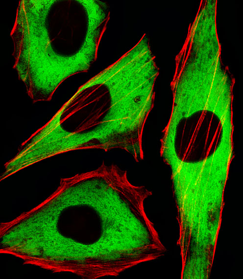 Fluorescent image of Hela cells stained with XAF1 GAPDH Antibody(Cat#AM1020b). AM1020b was diluted at 1:25 dilution.  An Alexa Fluor� 488-conjugated goat anti-mouse lgG at 1:400 dilution was used as the secondary antibody (green).  Cytoplasmic actin was counterstained with Alexa Fluor� 555 conjugated with Phalloidin (red).