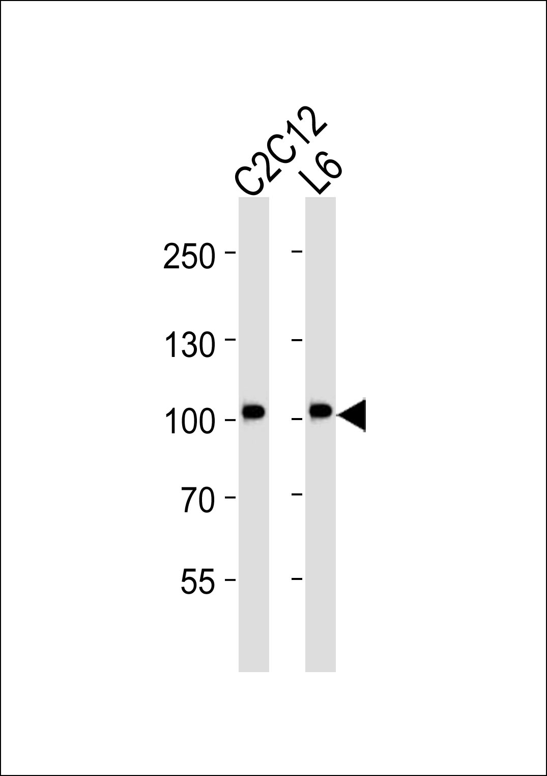 Western blot analysis of lysates from C2C12, L6 cell line (from left to right), using Musk Antibody(Cat.  #AM8443b). AM8443b was diluted at 1:2000 at each lane. A goat anti-mouse IgG H&L(HRP) at 1:3000 dilution was used as the secondary antibody. Lysates at 20?g per lane.