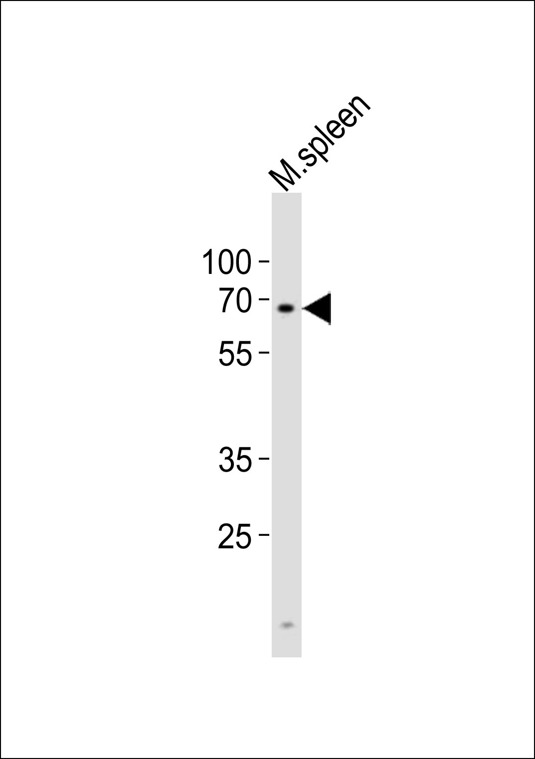 WB - Mouse Clk2 Antibody (N-term) AP14614a