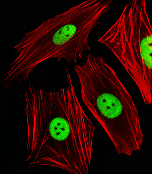 Fluorescent image of SH-SY5Y cells stained with ANP32E Antibody (N-term)(Cat#AP20559a). AP20559a was diluted at 1:25 dilution.  An Alexa Fluor 488-conjugated goat anti-rabbit lgG at 1:400 dilution was used as the secondary antibody (green).  Cytoplasmic actin was counterstained with Alexa Fluor� 555 conjugated with Phalloidin (red).