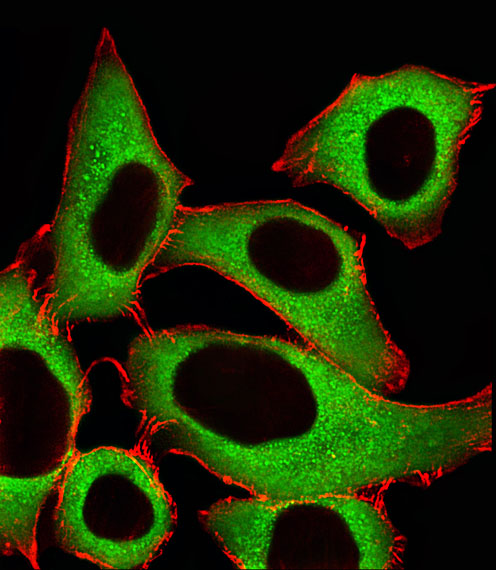 Fluorescent image of A549 cells stained with ALDH1A1 Antibody (Center)(Cat#AP20580c). AP20580c was diluted at 1:25 dilution. An Alexa Fluor 488-conjugated goat anti-rabbit lgG at 1:400 dilution was used as the secondary antibody (green).  Cytoplasmic actin was counterstained with Alexa Fluor� 555 conjugated with Phalloidin (red).